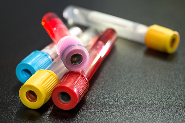 image depicting blood tests